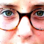 Quels sont les avantages de la rhinoplastie sur le plan esthétique et fonctionnel